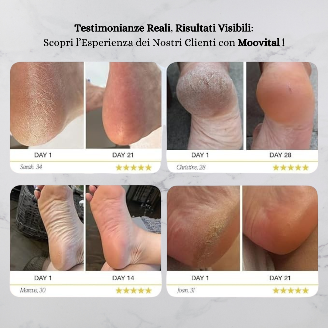 Moovital™ Rimuovi Calli Elettrico
