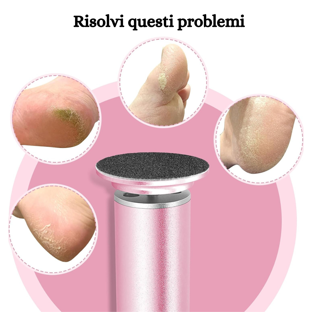 Moovital™ Rimuovi Calli Elettrico