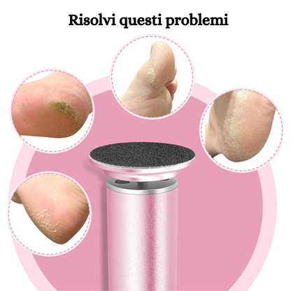 Moovital™ Rimuovi Calli Elettrico